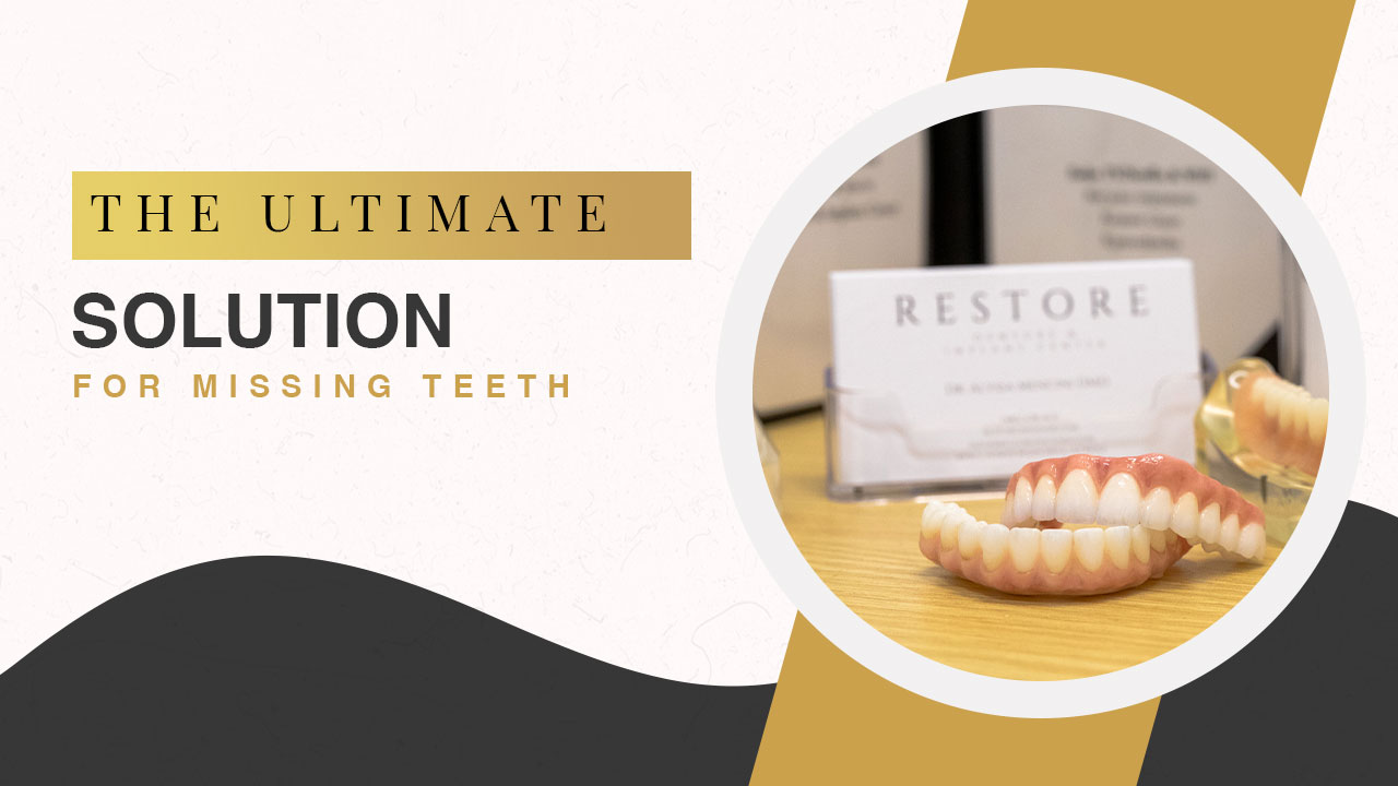 video cover stating: the ultimate solution for missing teeth